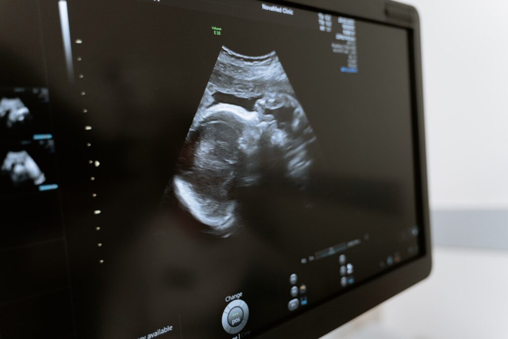 Image: Fetal Ultrasound